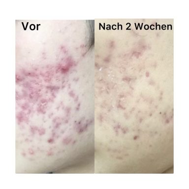 Gesichtsreinigung Gesichtsreinigung