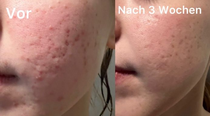 Gesichtsreinigung Gesichtsreinigung