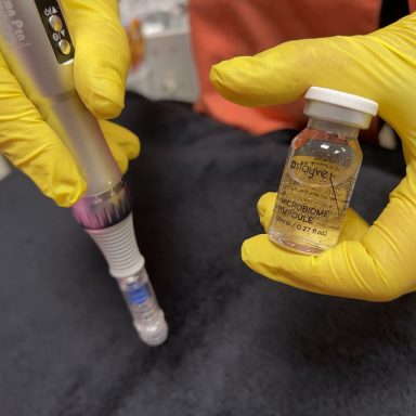 Dermapen fĂĽr Microneedling Dermapen fĂĽr Microneedling